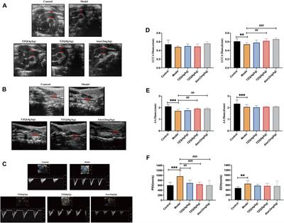Integrated pyroptosis measurement and metabolomics to elucidate the effect and mechanism of tangzhiqing on atherosclerosis